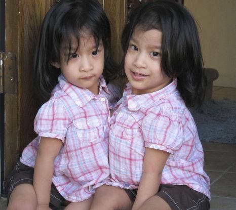 Сиамские близнецы Анжелика и Анджелина