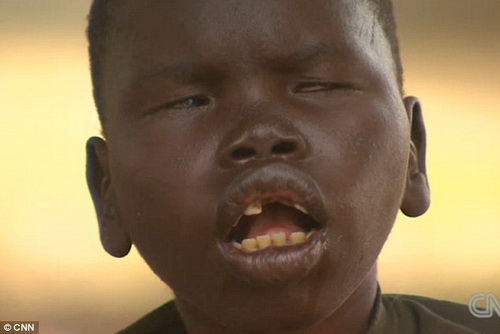 Дети "зомби" - таинственная болезнь в Африке