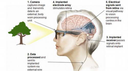 Схема работы бионического глаза