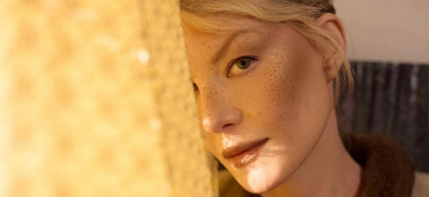 Рената Литвинова и веснушки